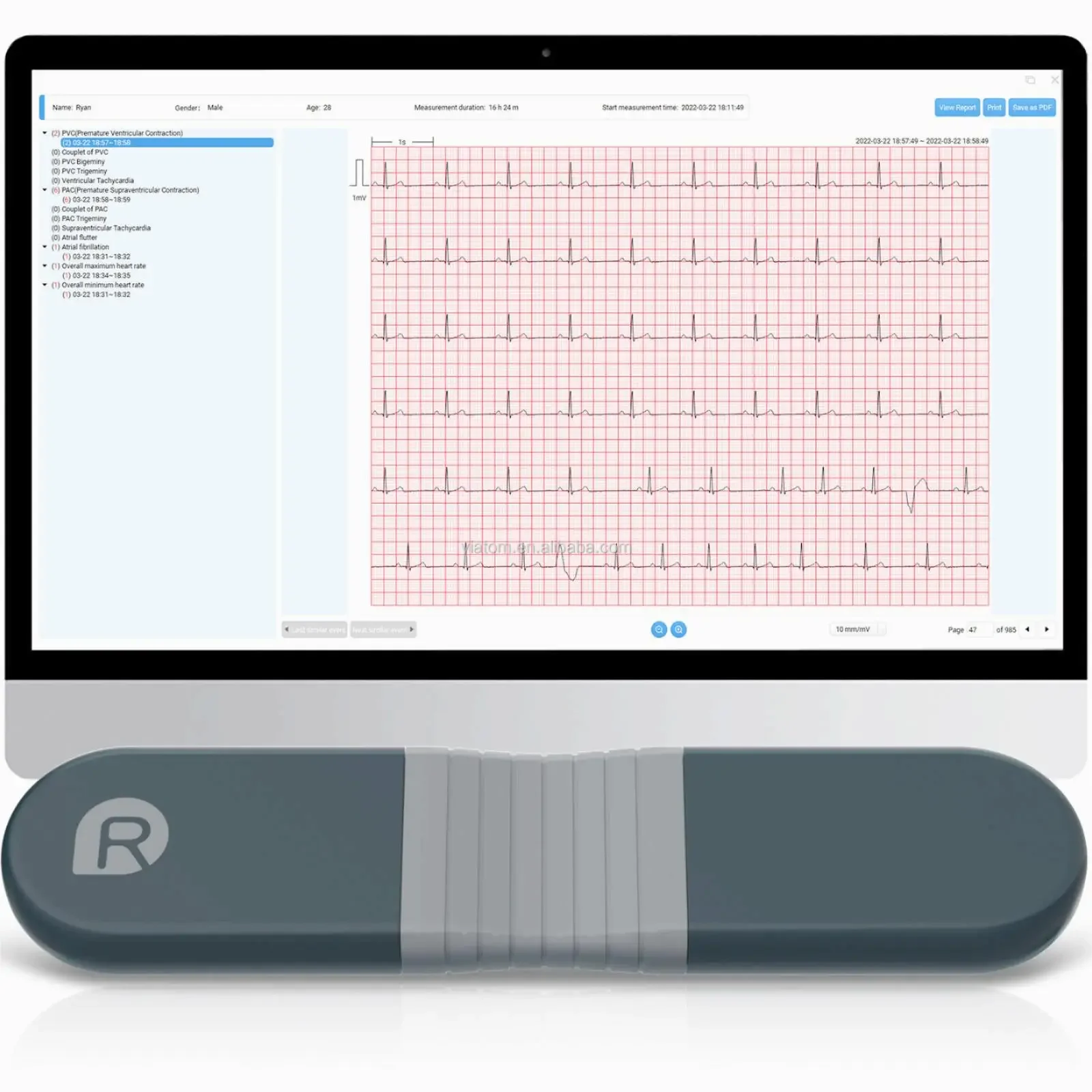 Wireless Bluetooth Dynamic Rec - Ecg Patch Monitor reseña y precio